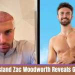 Love Island Zac Woodworth Reveals Graphic Details of Pre-Show Hair Transplant